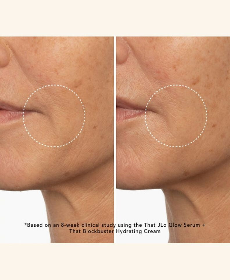 brightening serum before and after 8 weeks - corners of mouth