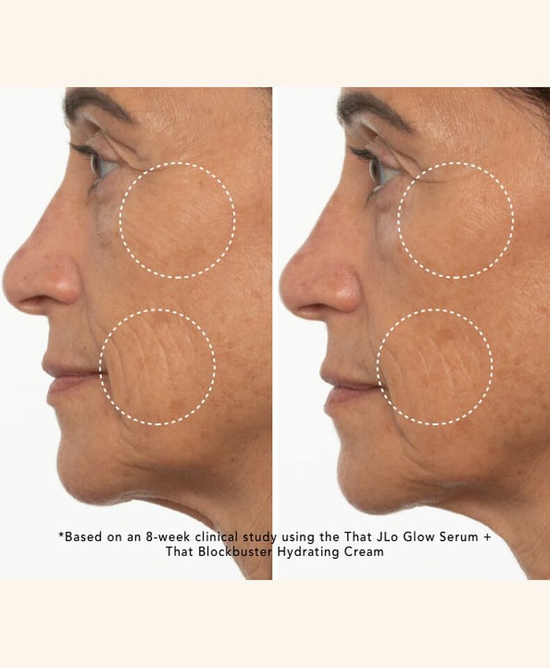 roxanne - brightening serum + hyrdating cream - before and after lines on cheeks