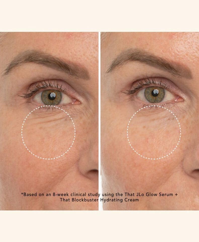 brightening serum before and after 8 weeks - corners of mouth